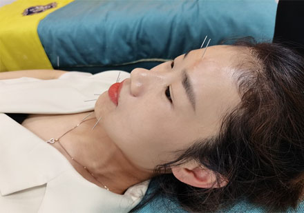 中医针灸班